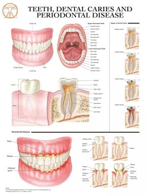 BS148RR-Teeth, Dental Caries, and Periodontal(1)